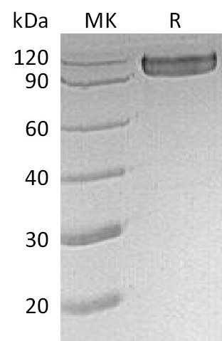 Human CD30 +SDS-PAGE-1.jpg